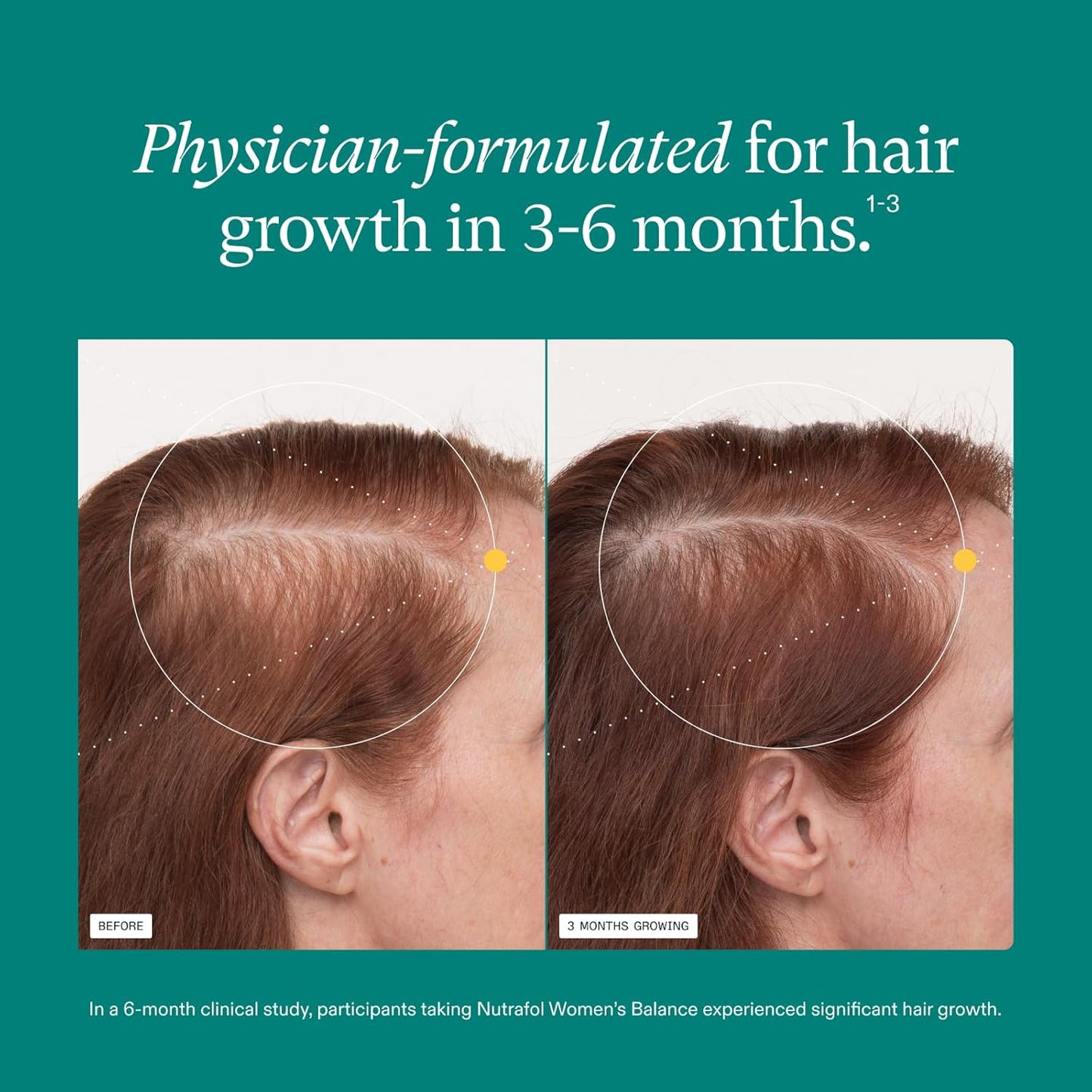 Nutrafol Women's Balance Hair Growth Supplement – Clinically Proven for Enhanced Hair Thickness