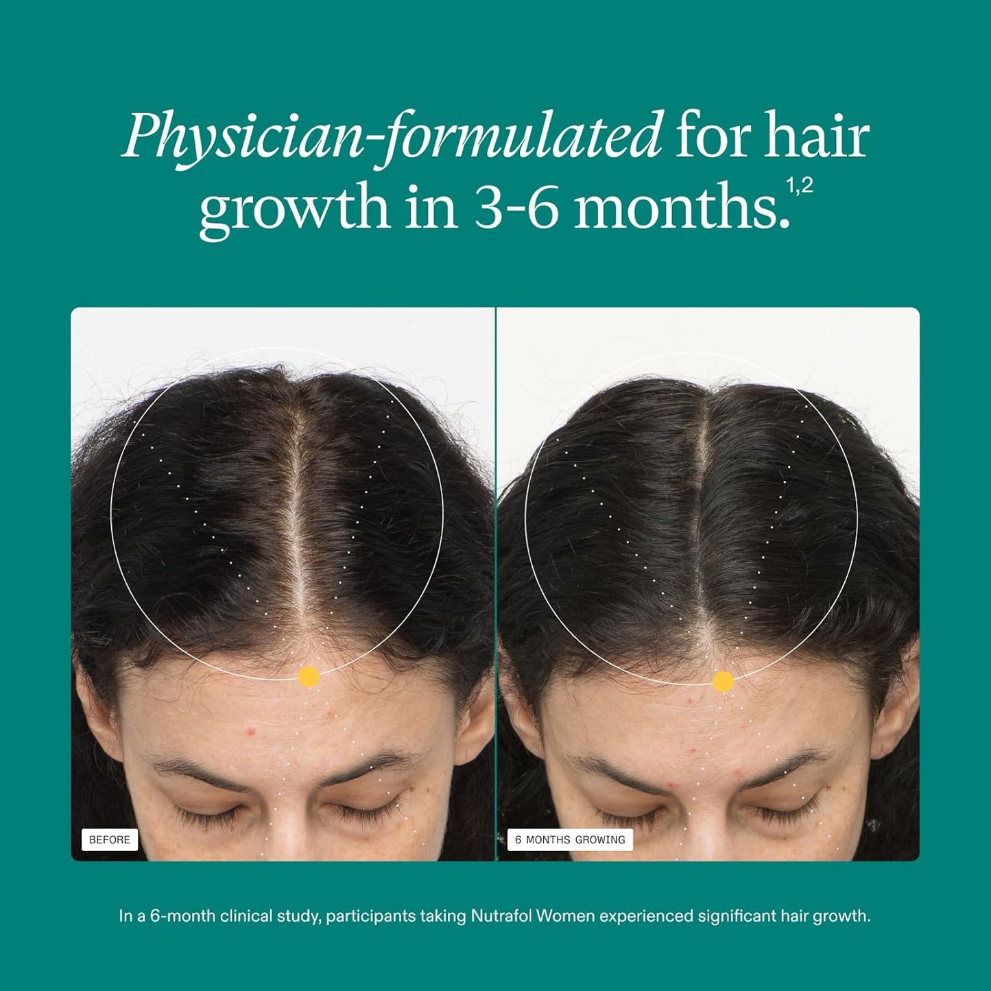 Nutrafol Women's Balance Hair Growth Supplement – Age 18-44